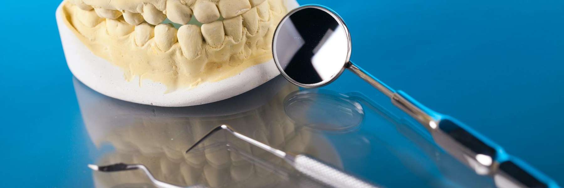 A picture of a dental moulding