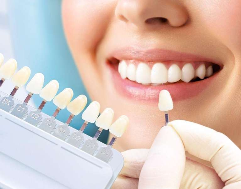 A woman smiling showing whiter teeth after visiting the dentist in Pikesville