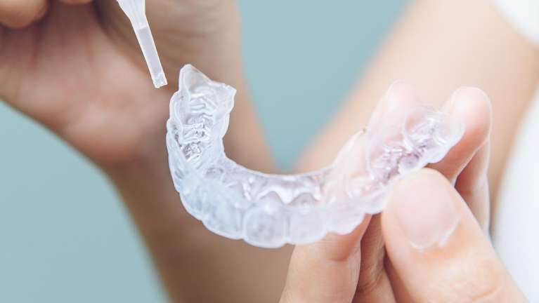 Invisalign in Pikesville, MD