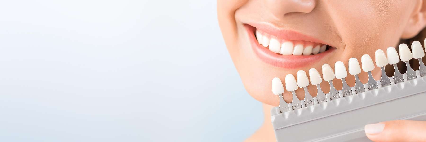 Teeth whitening shade guide in Pikesville, MD